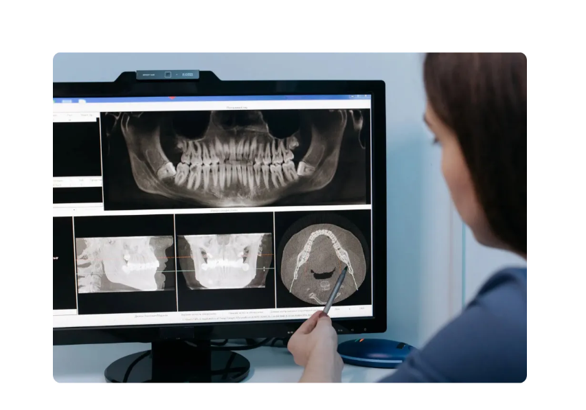 Tannlege studerer digital røntgen av kjeve før implantatbehandling